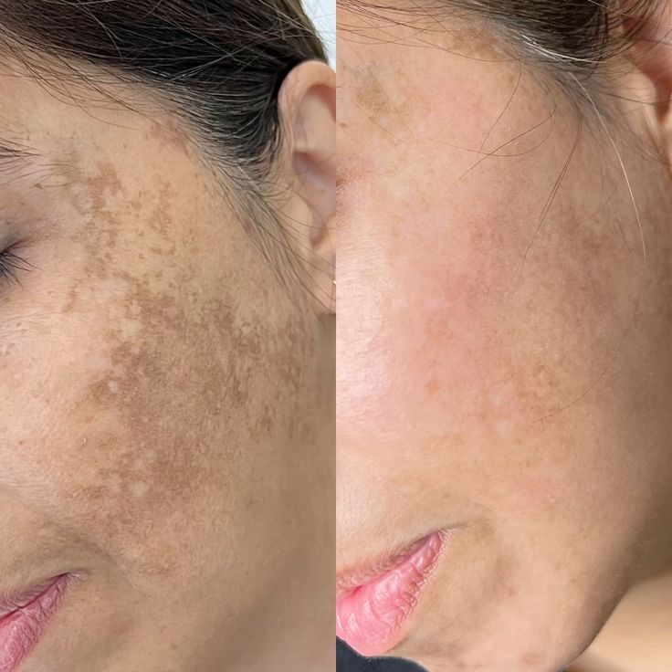 CREMA FACIAL HIDRATANTE DE ZANAHO